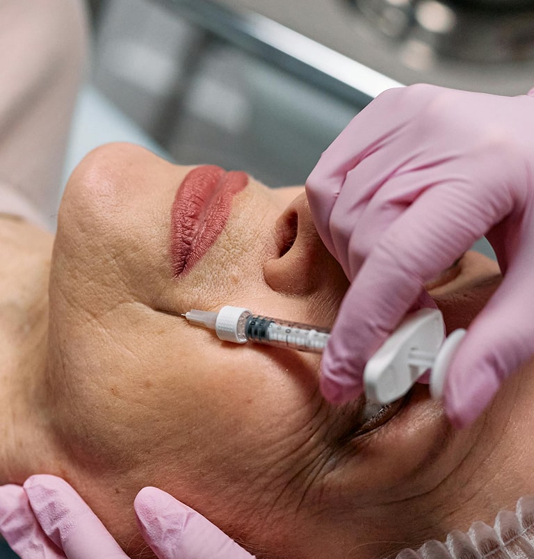 PRP and mesotherapy treatment